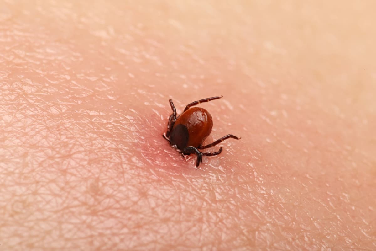 Comprehensive Guide to Tick Bite and Lyme Disease Prevention