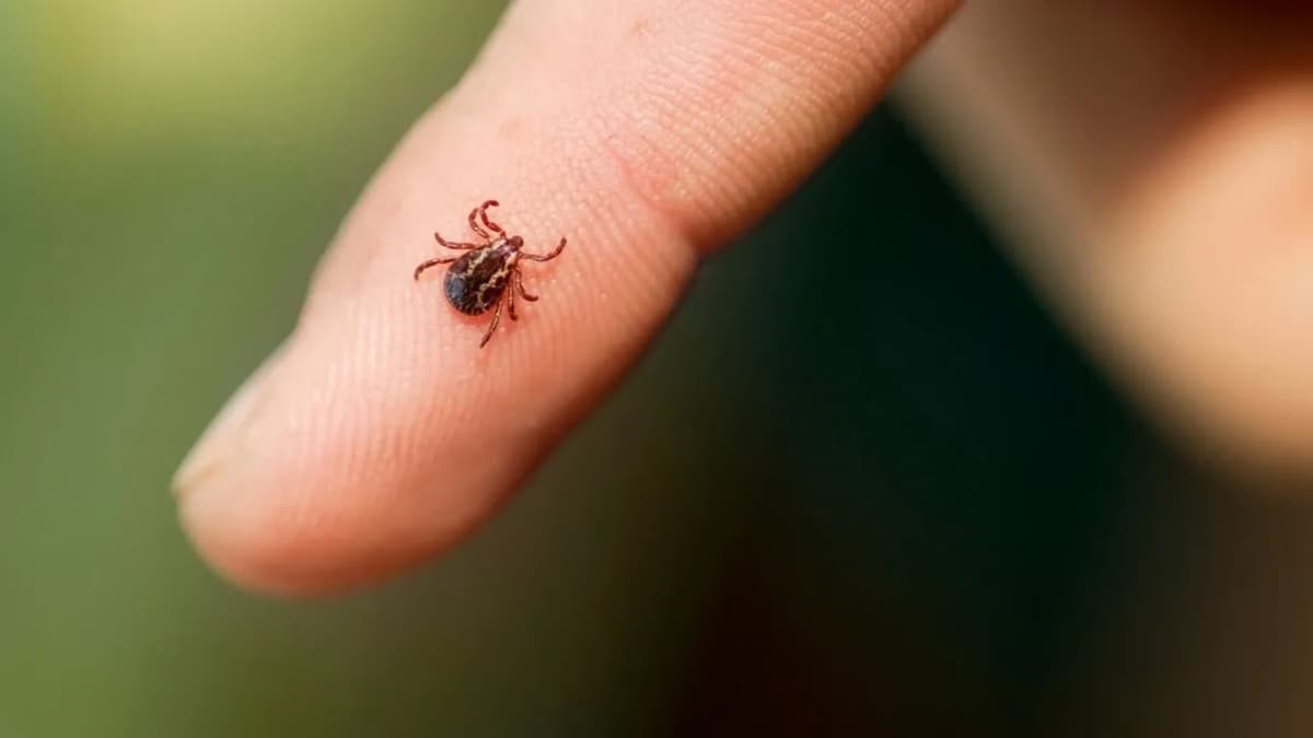 Ways to prevent ticks and lice
